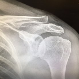 Bagshot 3's V Sonning 3's